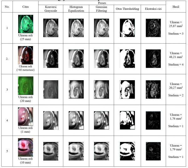 Training Pelatihan Kursus Jasa Python | Membuat Aplikasi Deteksi Kanker Serviks Menggunakan Image Prossesing Input Citra